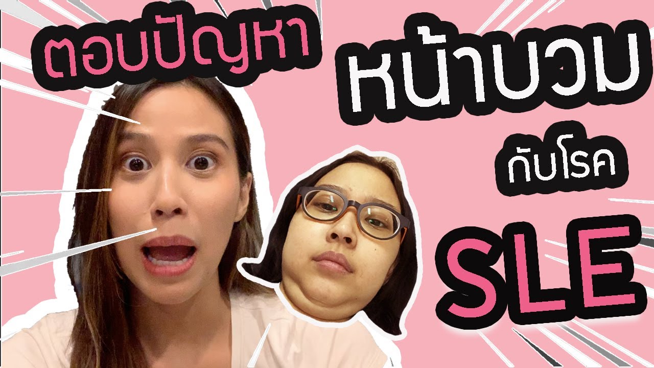 อีป่วย EP.1 เคลียร์ปัญหาหน้าบวมกับโรคSLE