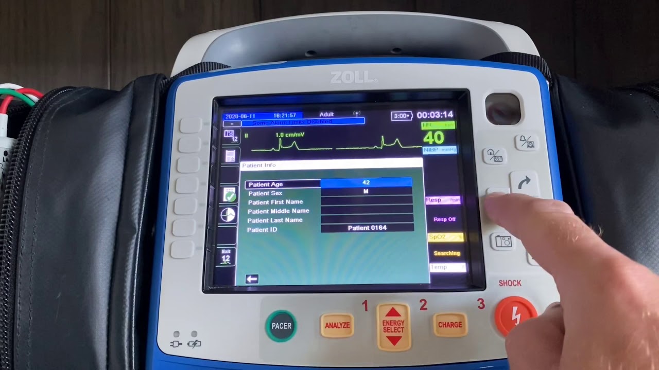 12-Lead ECG Process on the ZOLL X Series-ZOLL Tips and Tricks
