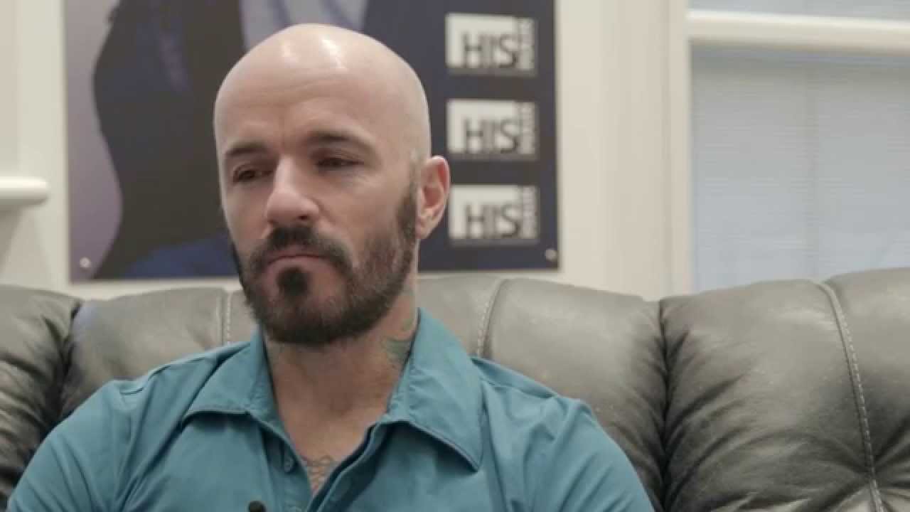 HIS Hair Clinic - Arri's Scalp Micropigmentation Soft Natural Hairline Receded Look