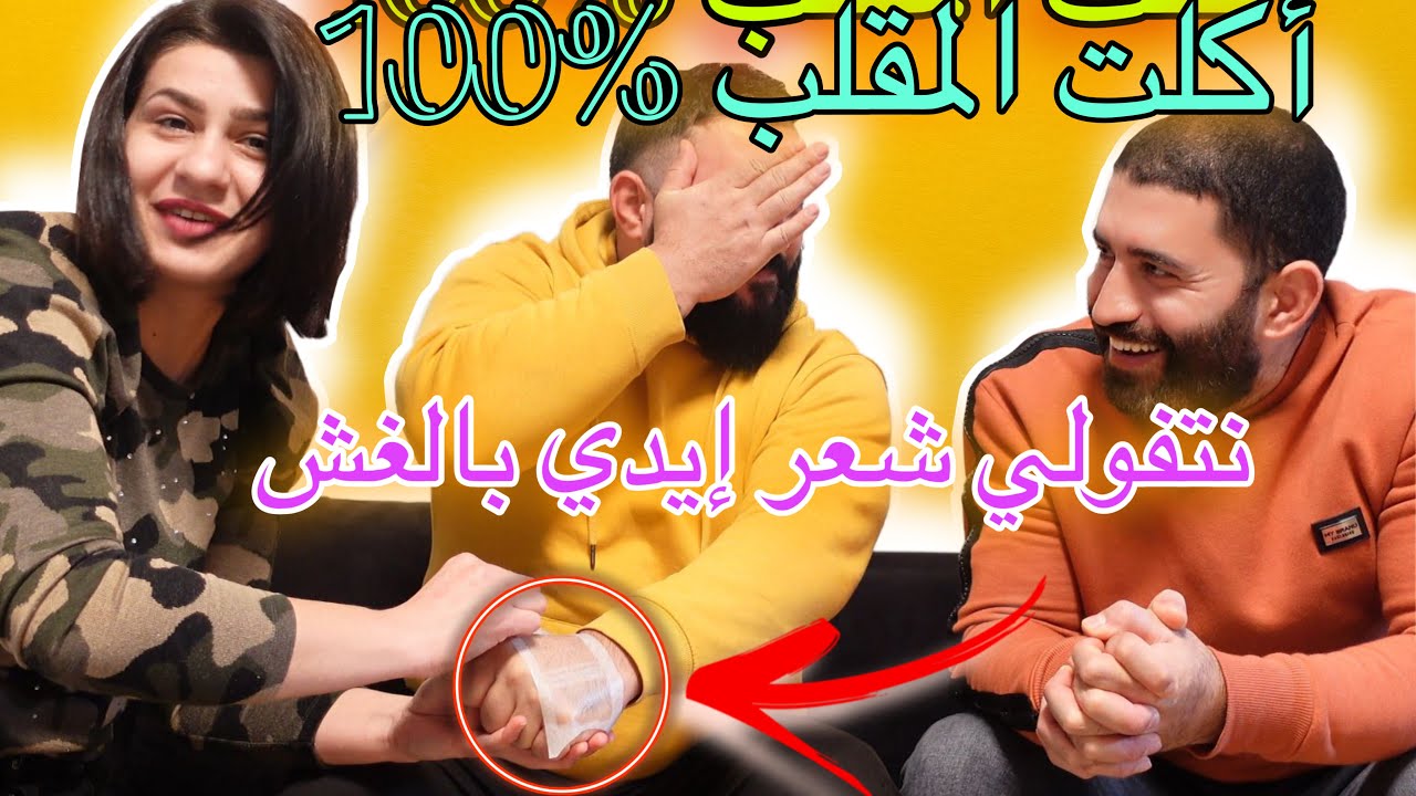 مقلب ازالة الشعر ب ابو روي تمت العملية بنجاح %100