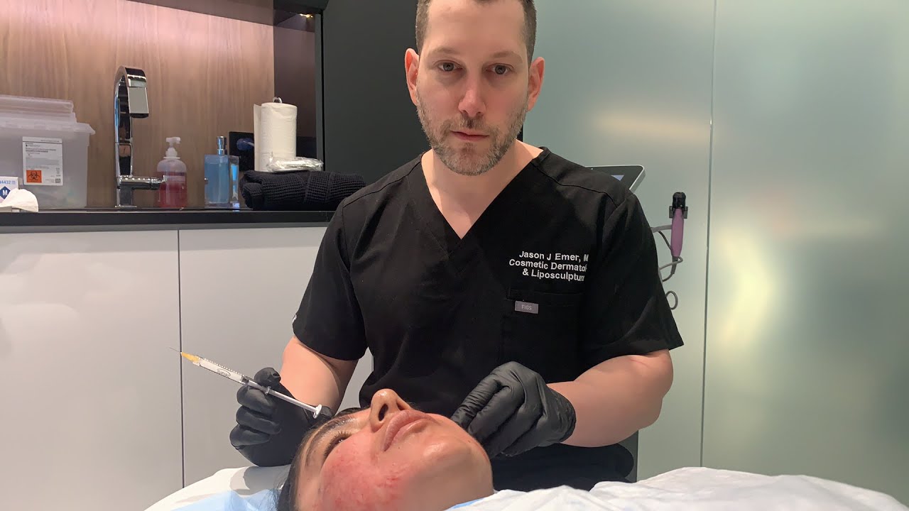 How to Get Rid of Acne Scars | Dermal Filler/Subcision | Acne Scar Combination Tx | Part 1 | Dr Emer