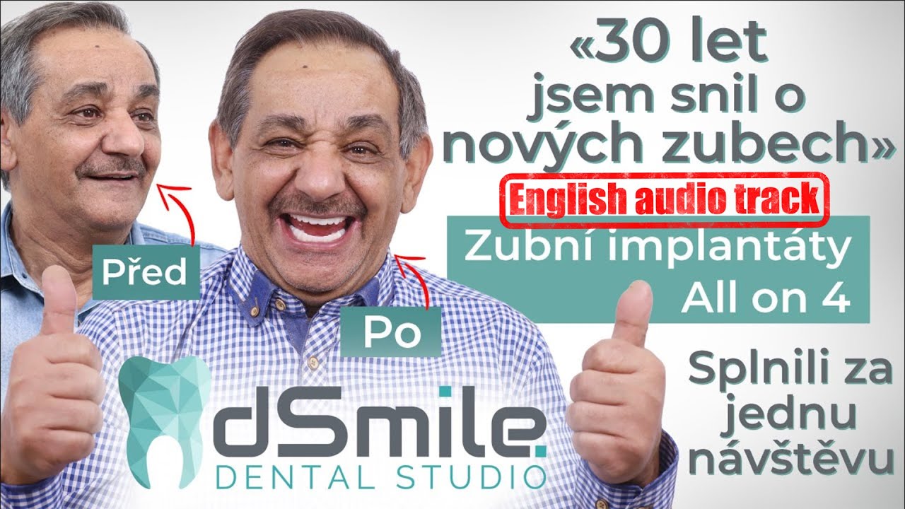 Nové zuby napevno za jeden den! Zubní implantáty v Praze