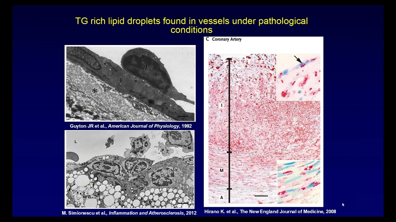 Lipid Metabolism by the Endothelium - Lecture by Dr. William C. Sessa