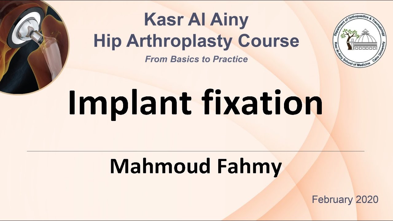 1-5 Implant fixation - Mahmoud Fahmy