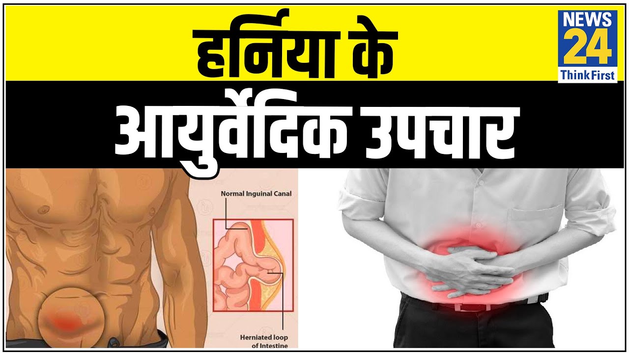 Sanjeevani : हर्निया के आयुर्वेदिक उपचार, Ayurvedic treatment of hernia || News24