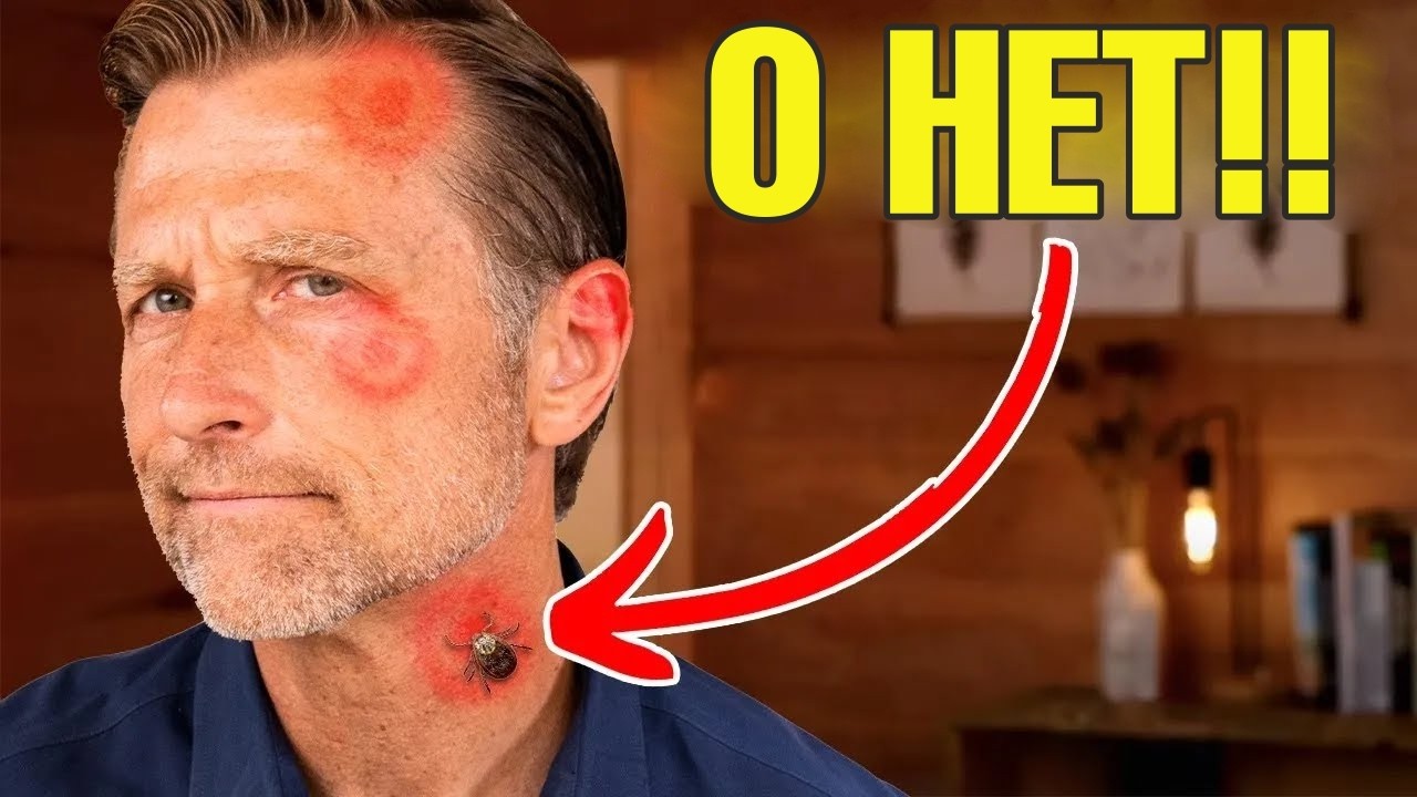 Как предотвратить боррелиоз (болезнь Лайма)?🧐