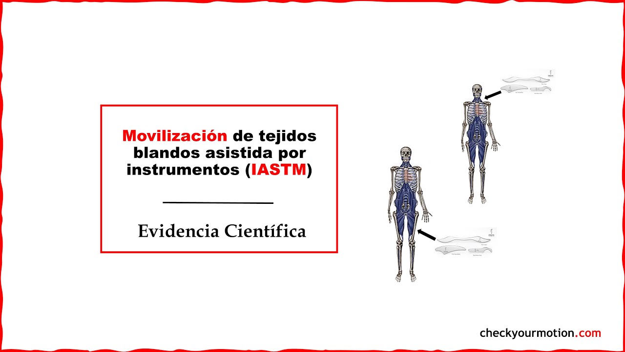 ¿Qué es IASTM? La movilización de tejidos blandos asistida por instrumentos