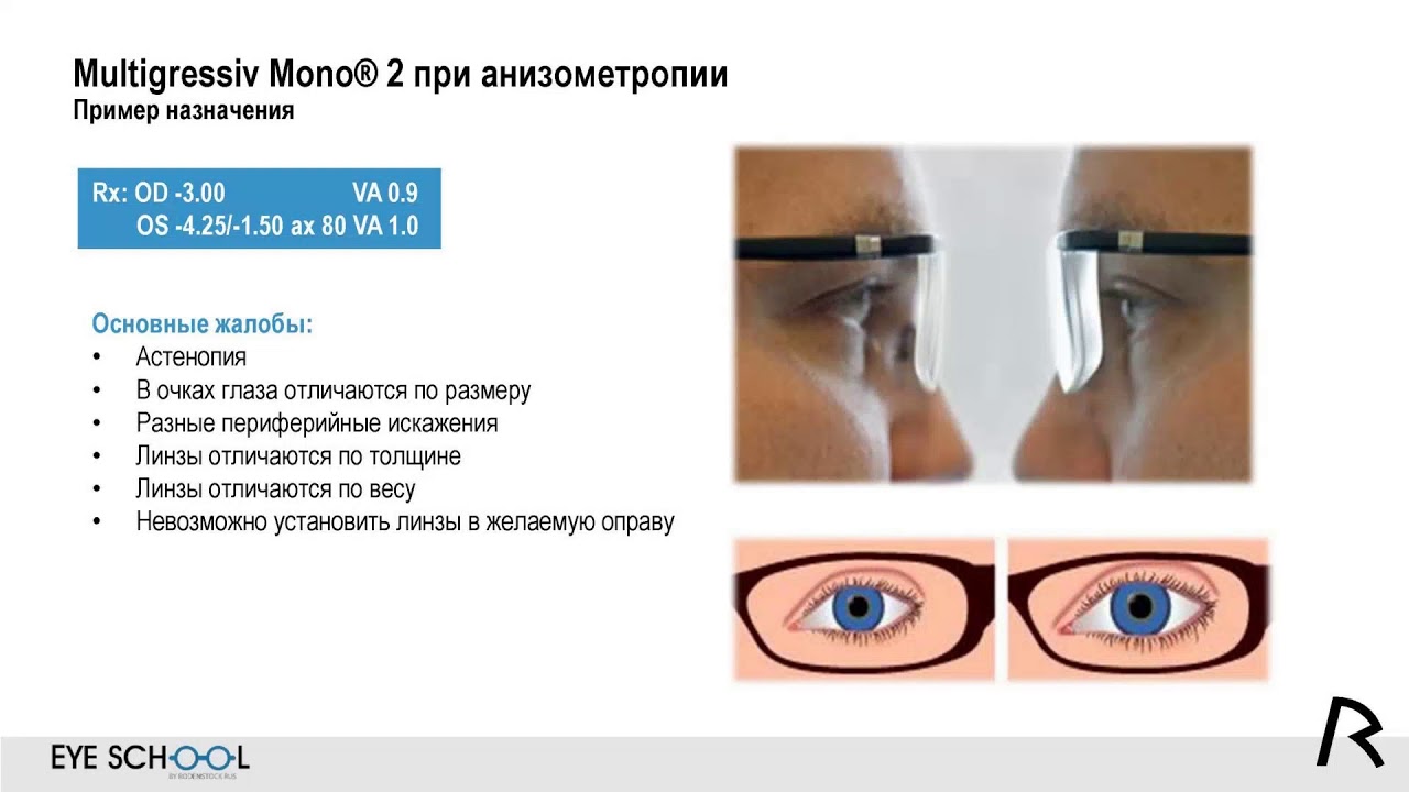 Multigressiv Mono 2