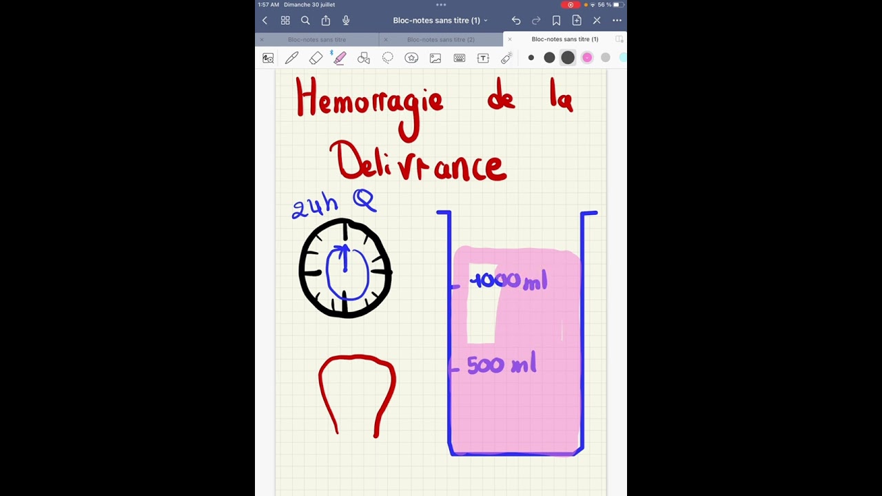 Hémorragie de la délivrance