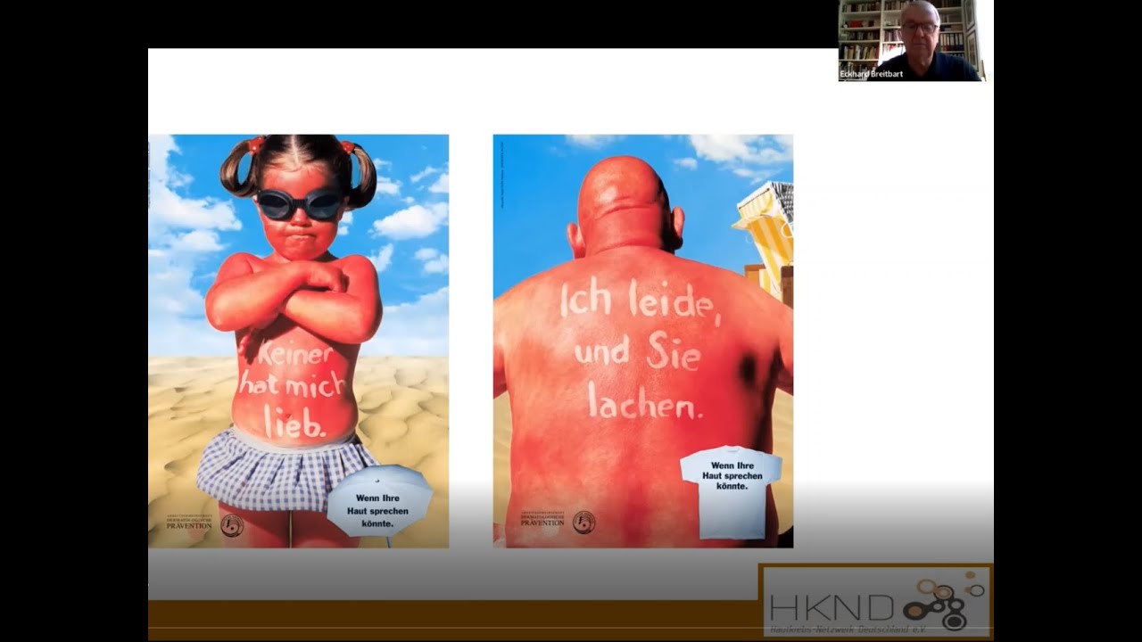Hautkrebs - ist die Sonne jetzt mein Feind? Vortrag zum UV-Schutz von Prof. Eckhard Breitbart
