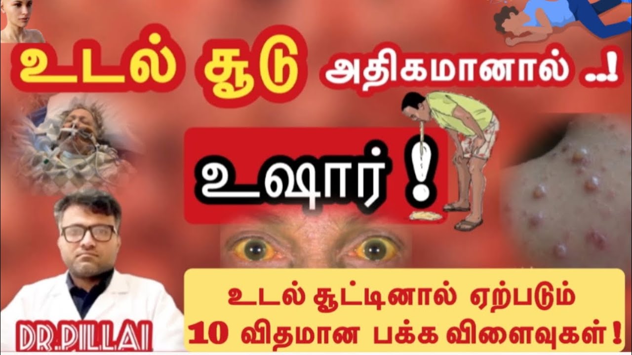 உடல் சூட்டினால் உண்டாகும் 10 பக்க விளைவுகள்- உஷார் | Body heat - 10 Side Effects | Dr.Pillai | TAMIL