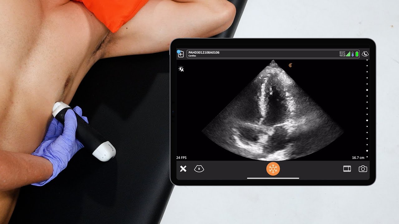 The Apical 4 chamber Cardiac View