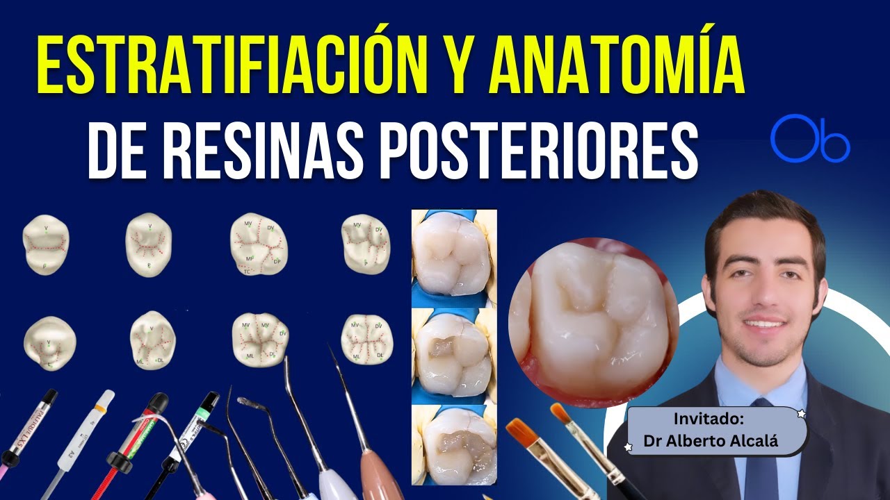 Estratificación y Anatomía de Resinas Posteriores 🦷 con Dr Alberto Alcalá