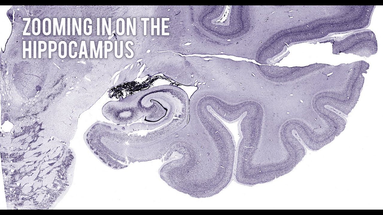 Zooming in on the hippocampus