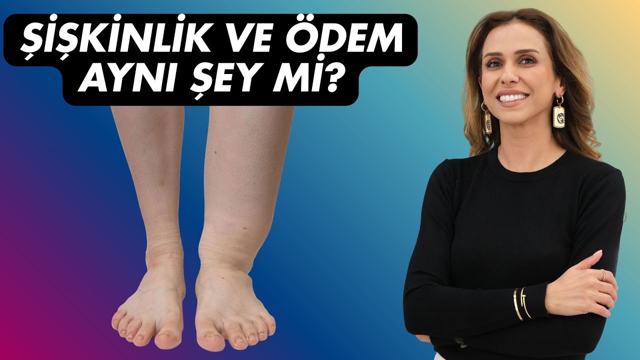 Geçmeyen Ödemin Sebebi Bu Olabilir!