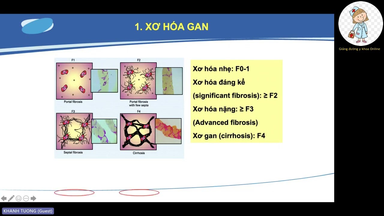 VIÊM GAN | PGS. TS. BSCK2. Trần Thị Khánh Tường