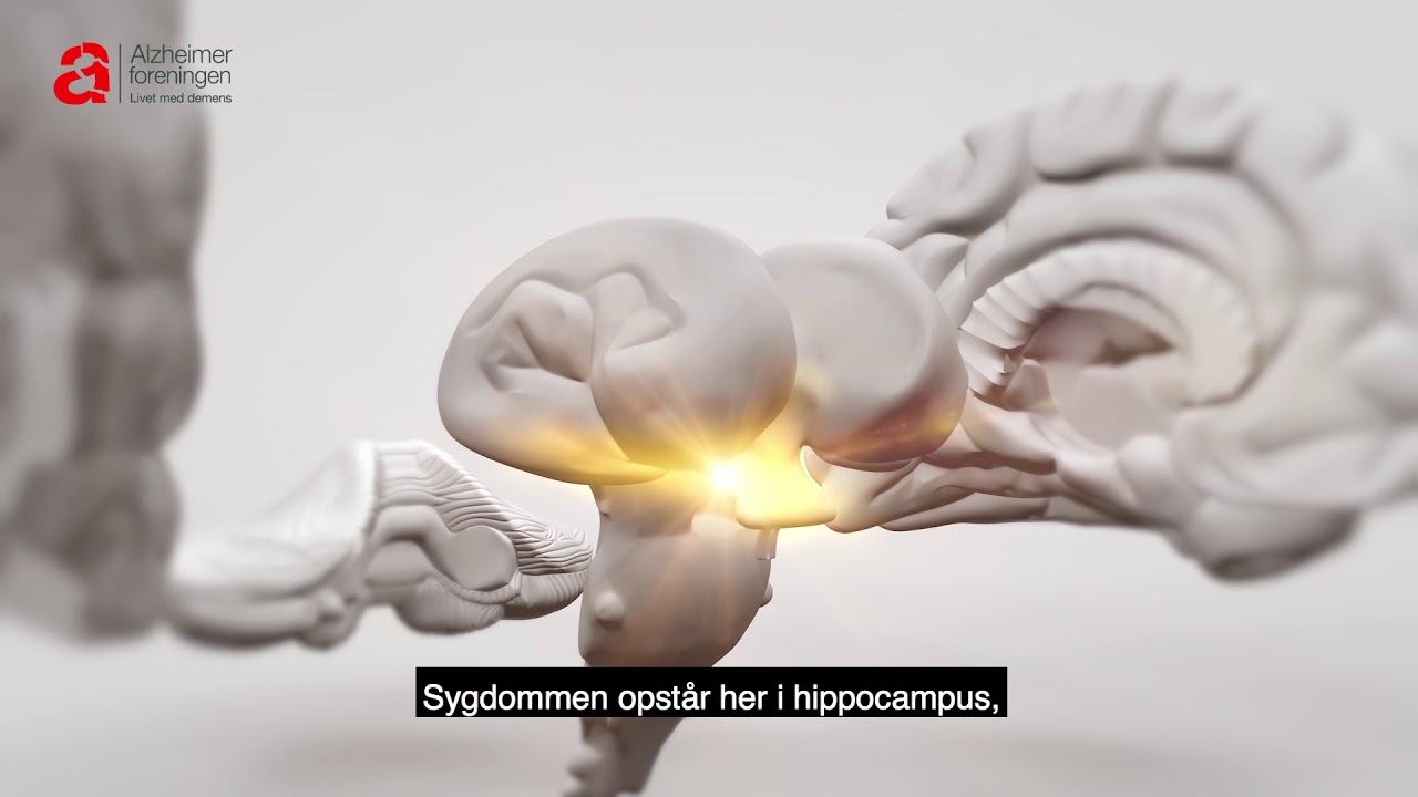 Hvad er demens? Alzheimerforeningen