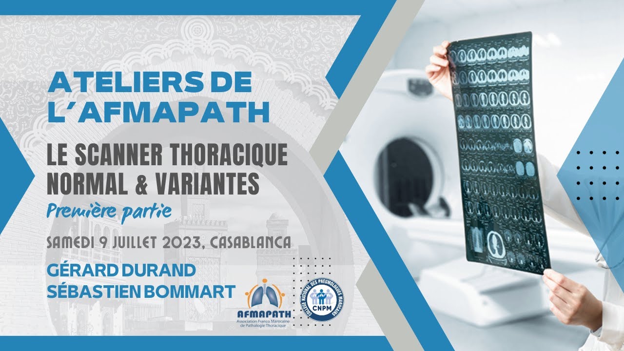 Le scanner thoracique normal et ses variantes. Première partie