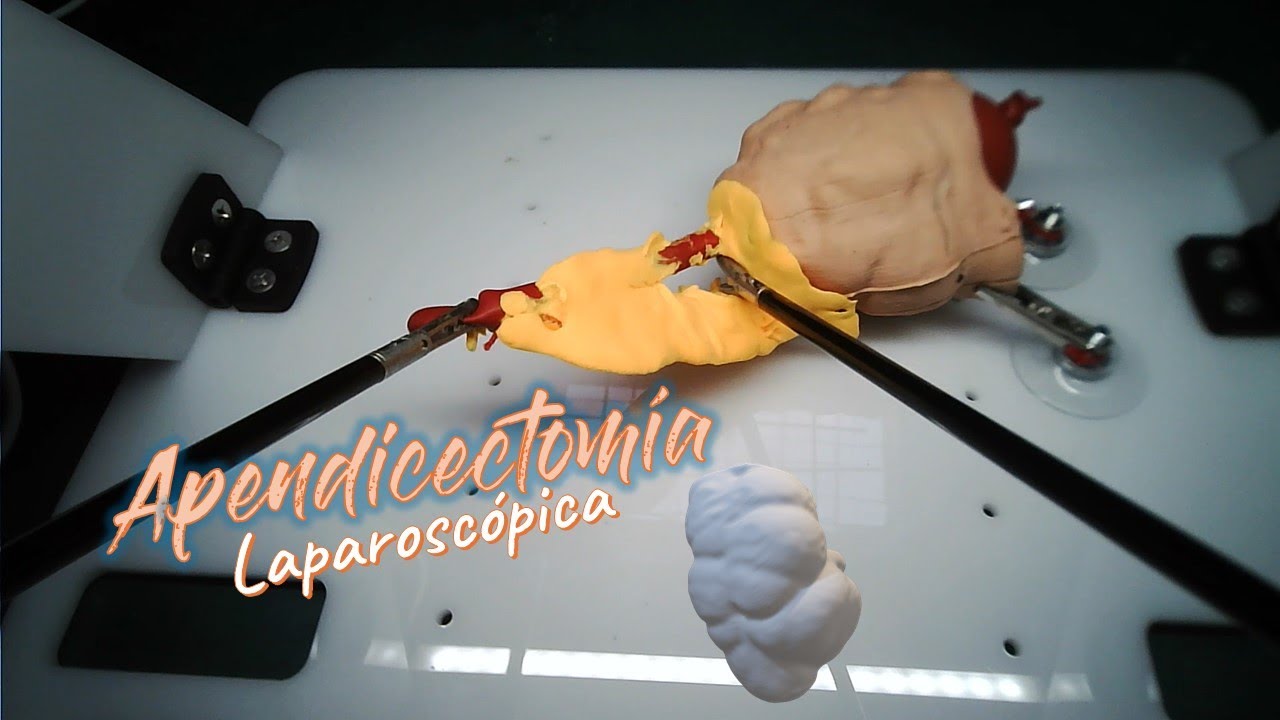 APENDICECTOMÍA LAPAROSCÓPICA modelo de simulación 3d