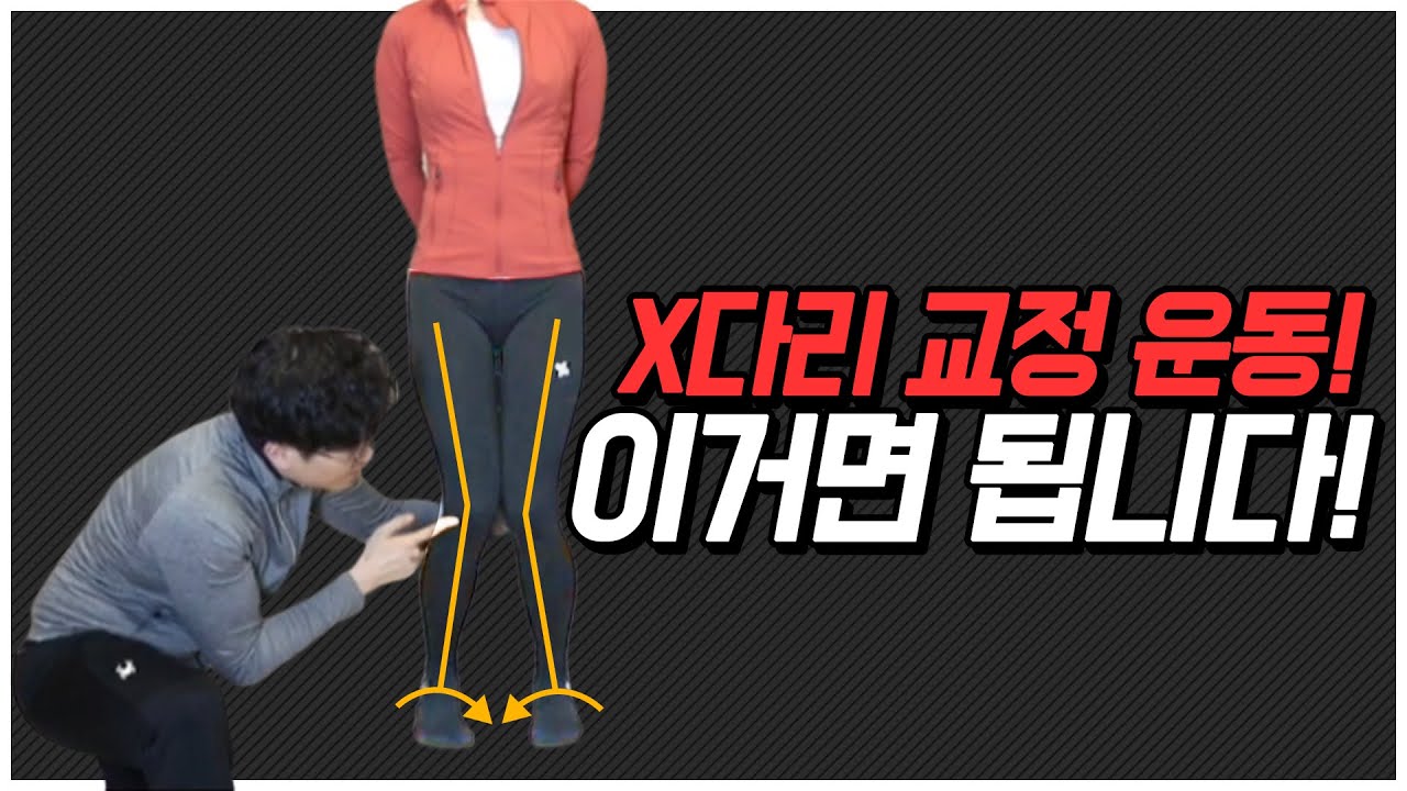 (Eng sub)단언컨대, 이것은 최고의 X다리 교정운동 루틴입니다/Definielty, this is the best exercise for knock knees