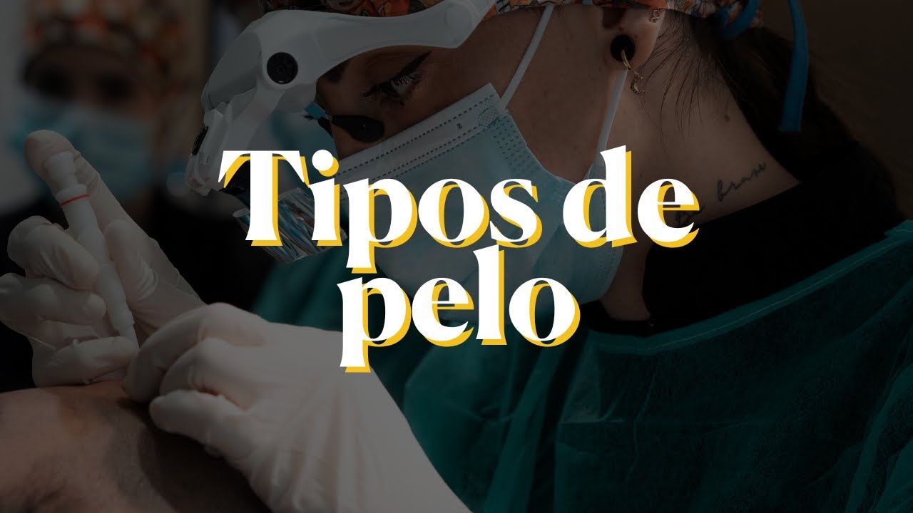 Tipos de pelo: ¿Cuál es el mejor para injerto capilar?