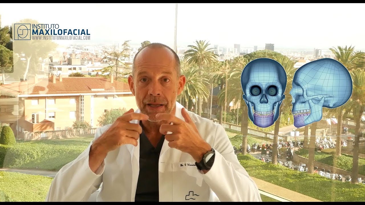 Modelado de la mandíbula