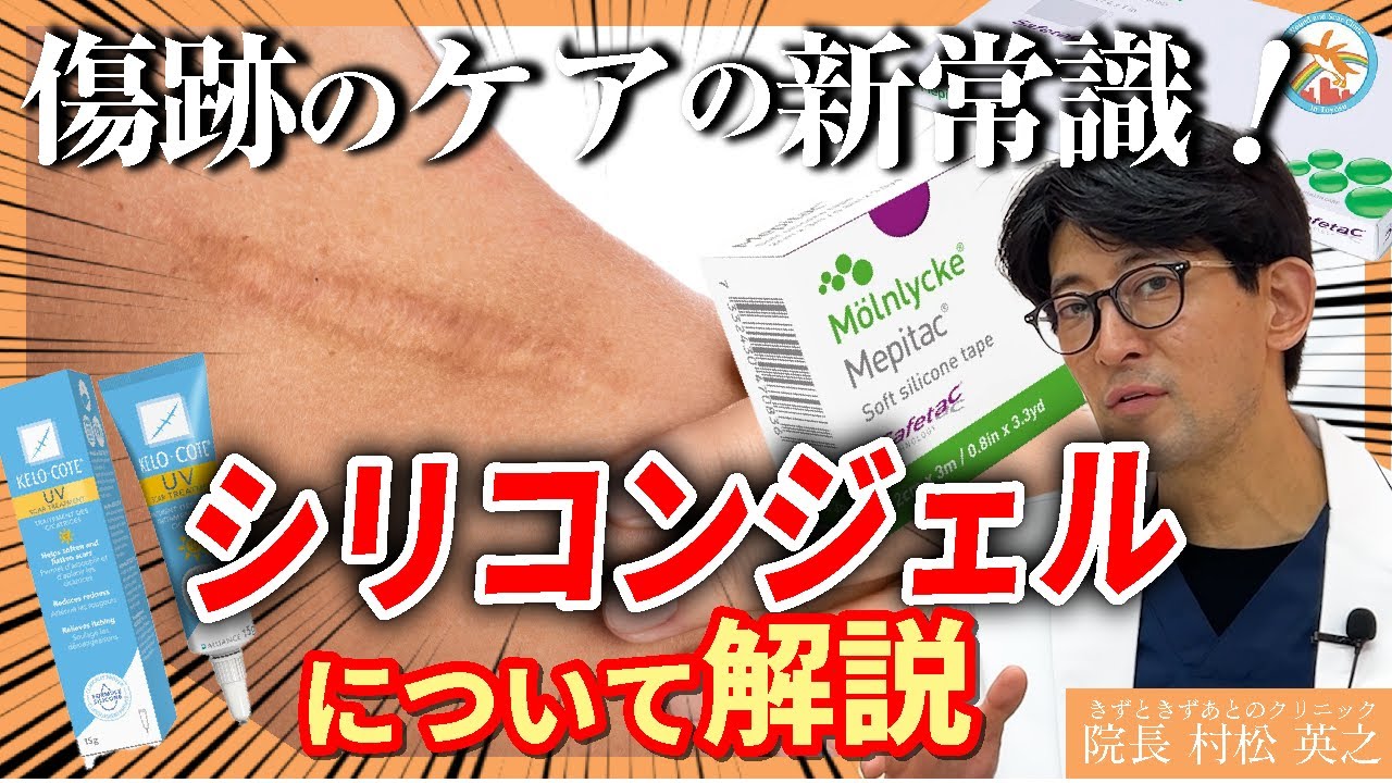 シリコンジェルシートで傷跡ケアの秘密を公開！