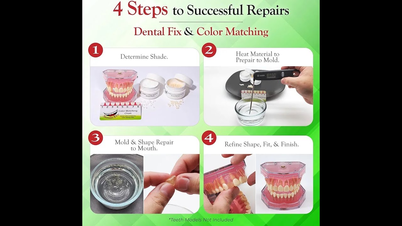 SmileFix Standard Dental Repair Kit  #Dental #amazon #productreviews #best #dentalhealth