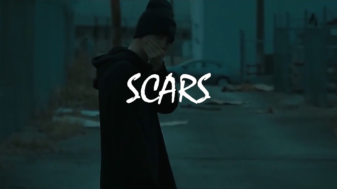 (Free) NF Type Beat - Scars