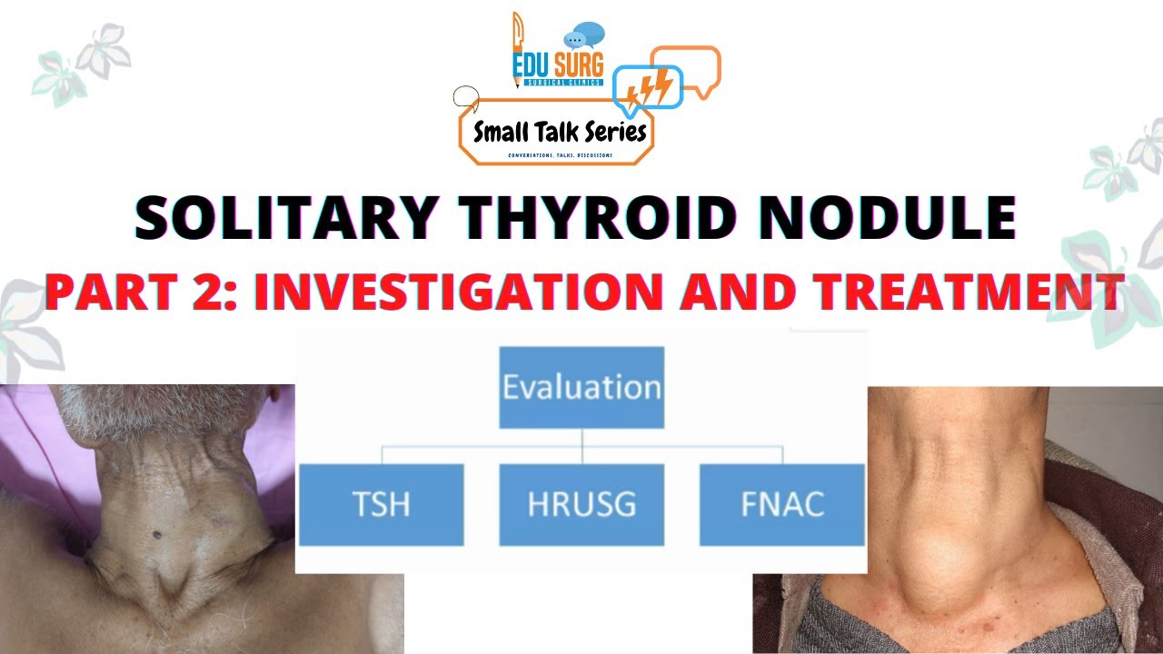 Management of solitary thyroid nodule - Part 2