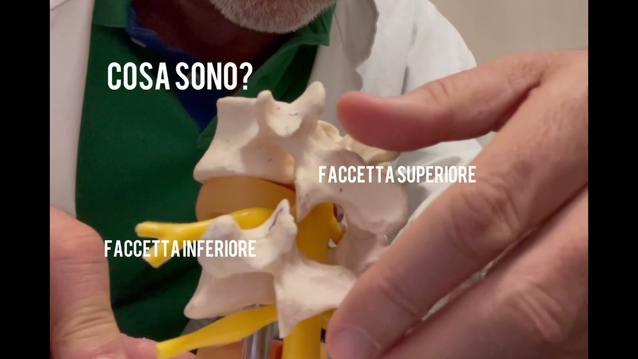 Infiltrazione Rx guidata faccette articolari lombari