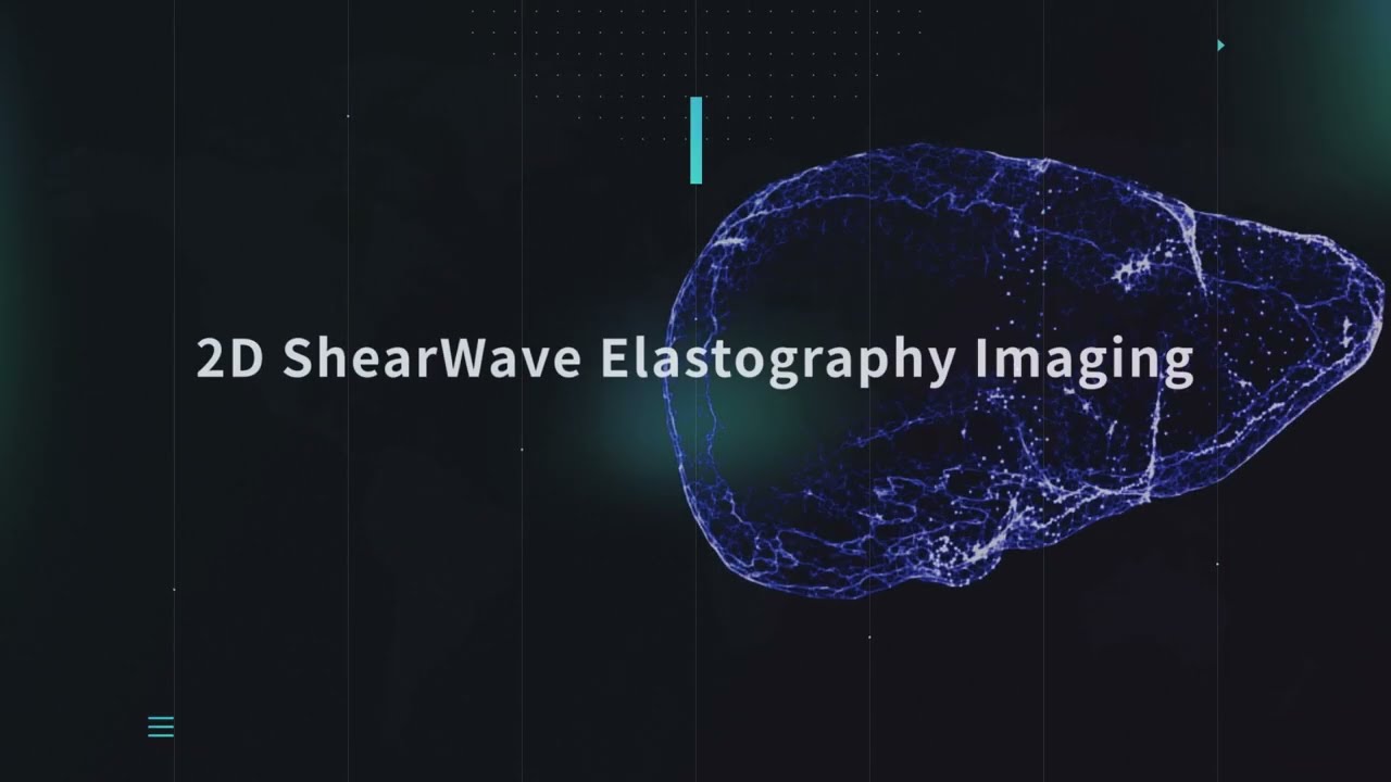 VShear Intro, VINNO's Shearwave Elastography