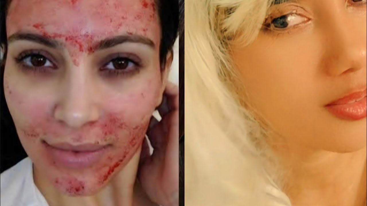APRENDI COM AS KARDASHIAN !     TRATAMENTO MARAVILHOSO QUE FUI PIONEIRA NA INTERNET e FAÇO há ANOS 
