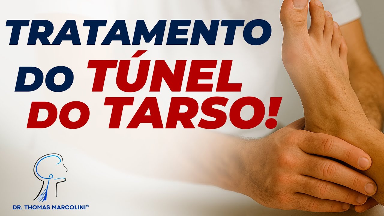 Nervo Preso no Pé? – Entenda a Síndrome do Túnel do Tarso!