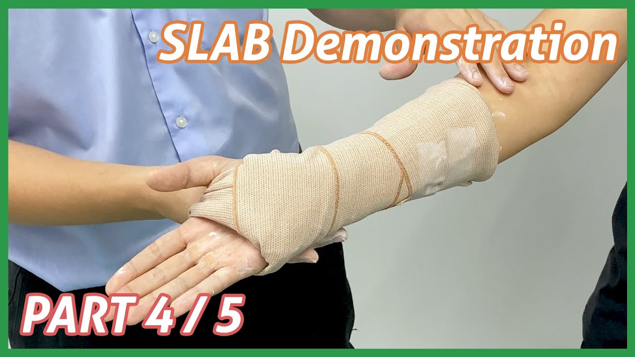 Immobilization for upper extremity fracture [Part 4/5] : Short arm slab