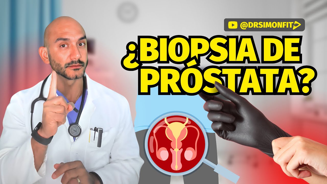 &iquest;C&Oacute;MO SE HACE UNA BIOPSIA DE PR&Oacute;STATA? &middot; C&aacute;ncer de Pr&oacute;stata