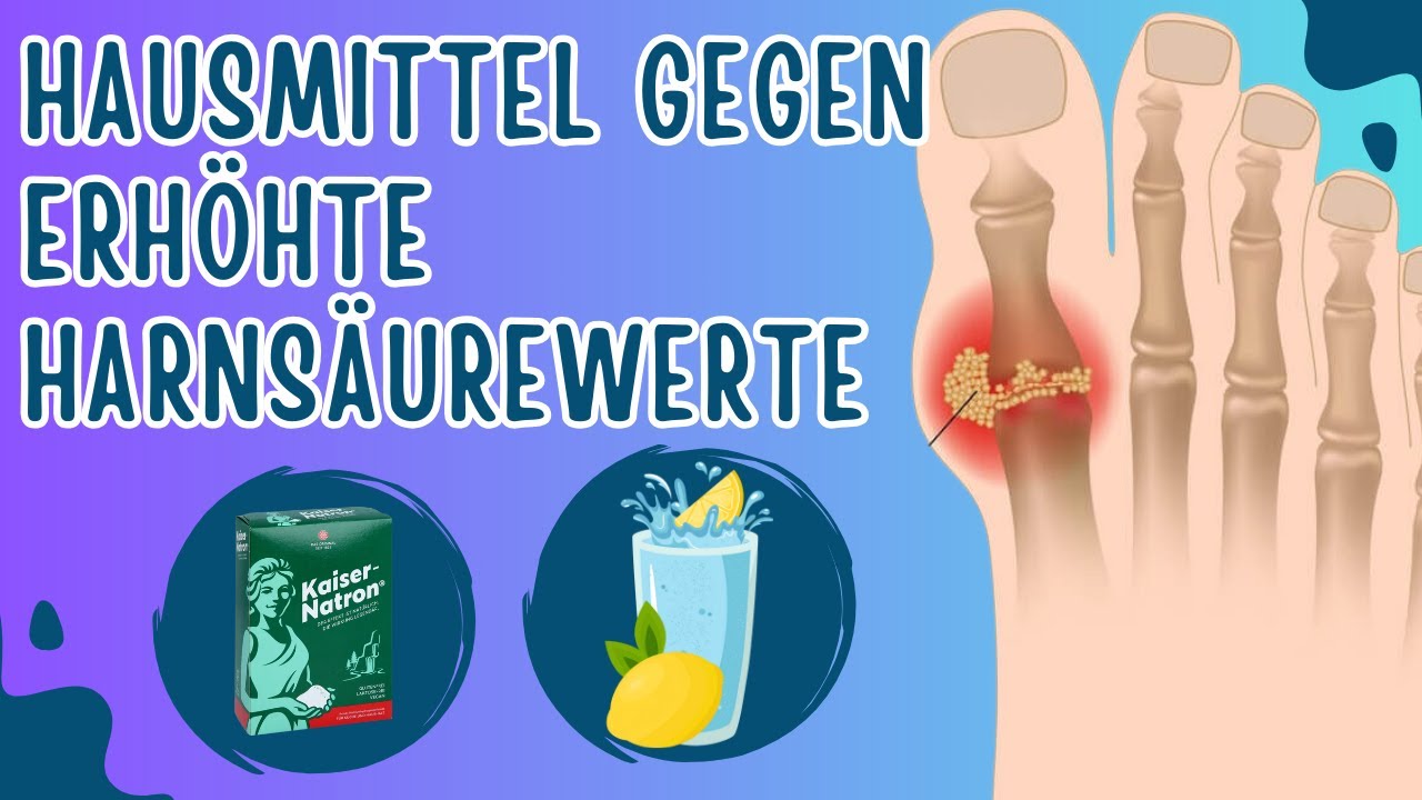 10 Nat&uuml;rliche Hausmittel gegen erh&ouml;hte Harns&auml;urewerte