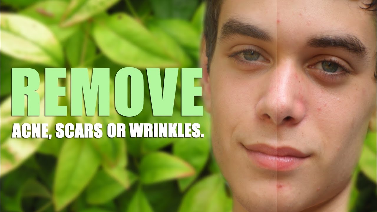 Remove Acne, Scars, or Wrinkles in Photoshop CC