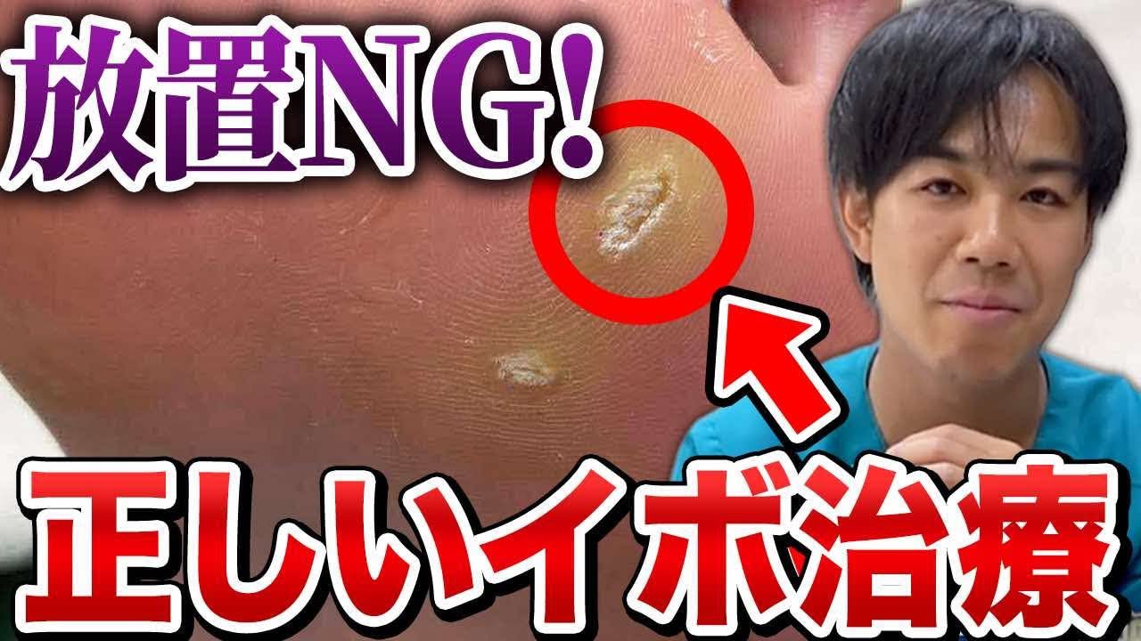 【足のトラブル】タコ？角質？イボ？正しい見分け方と治療方法について