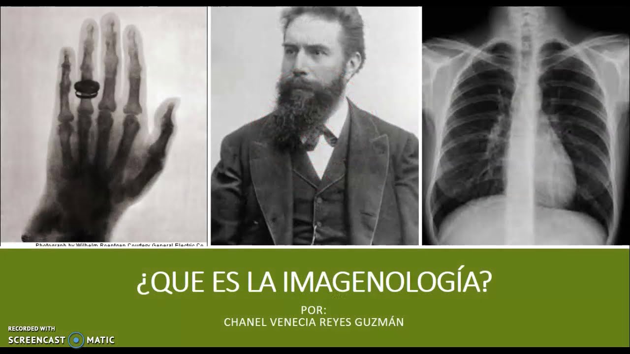 &iquest;QU&Eacute; ES LA IMAGENOLOG&Iacute;A?