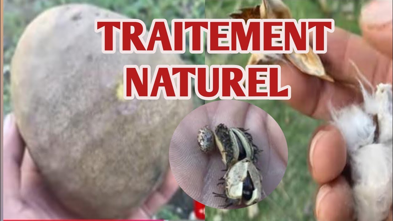Vidéo sa gen traitement pou tout maladi