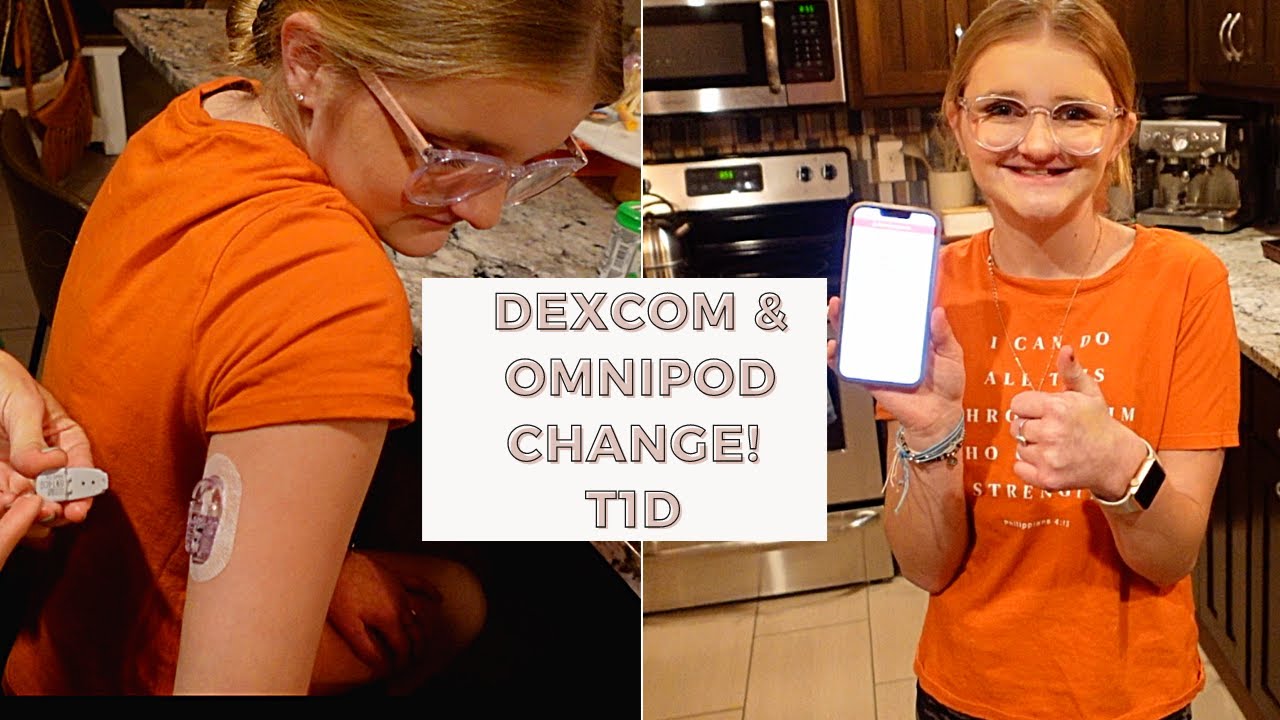 DEXCOM G6 & INSULIN PUMP CHANGE | #NOHURT NO MORE?