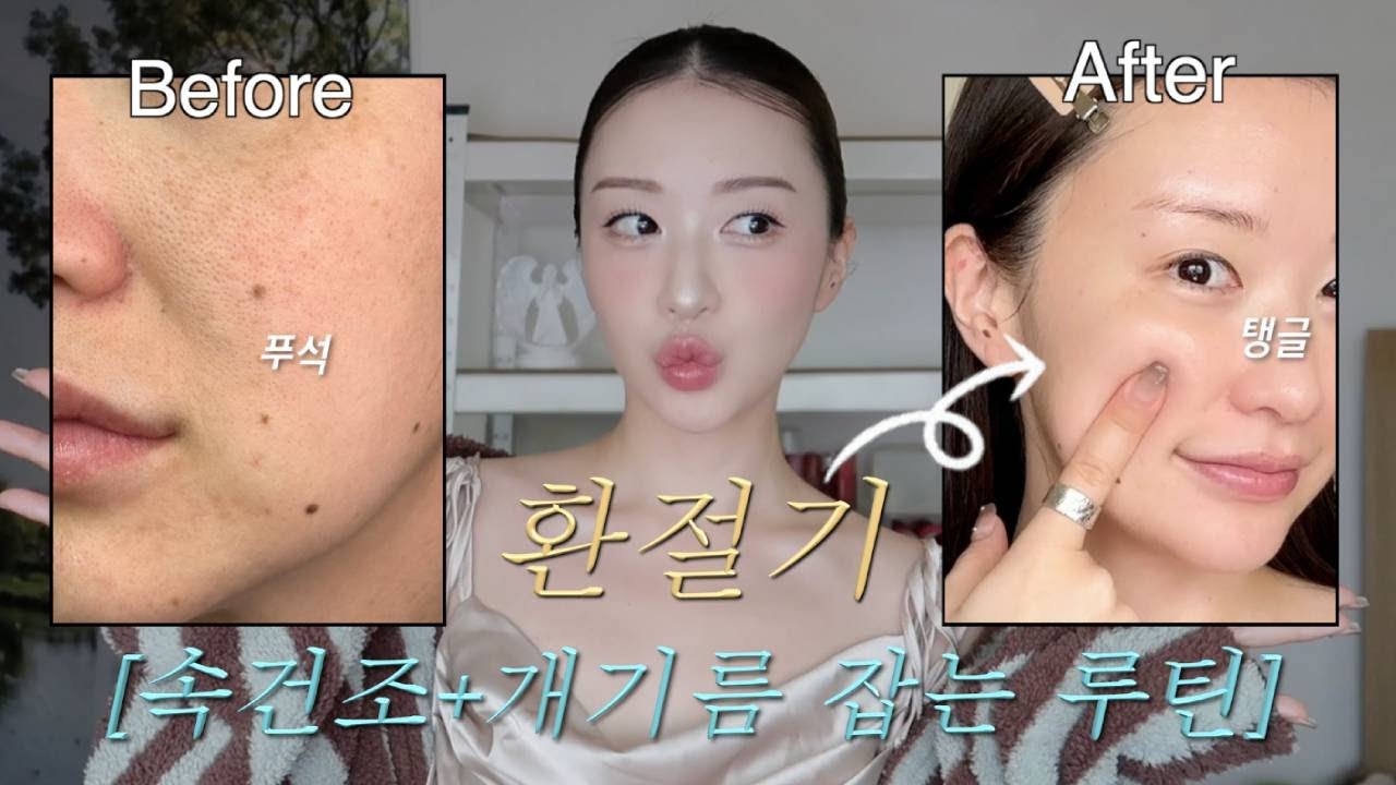 🚨환절기 속건조+개기름 잡는 꿀팁 #수부지#PDRN