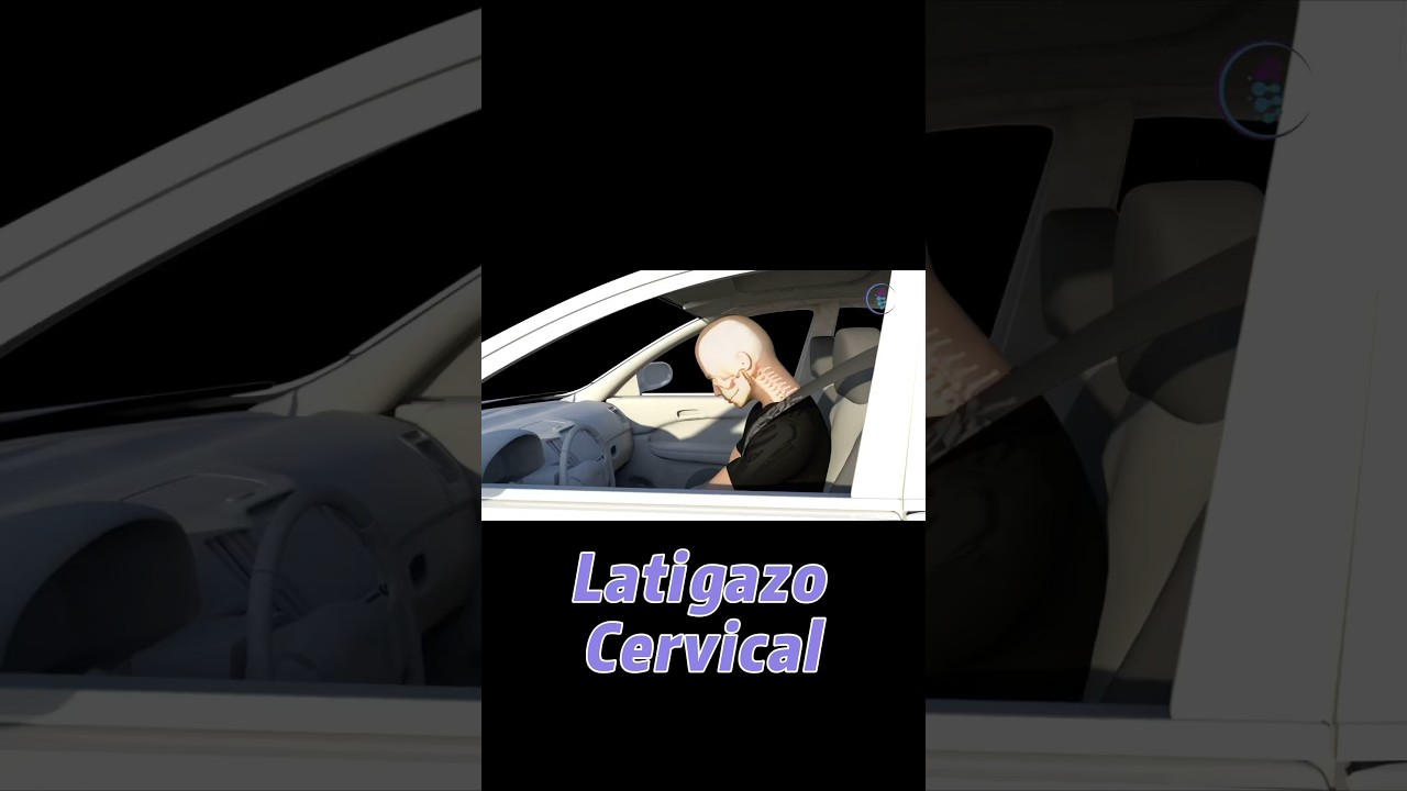 Lesi&oacute;n m&aacute;s com&uacute;n en accidentes automovil&iacute;sticos #latigazocervical #lesiones