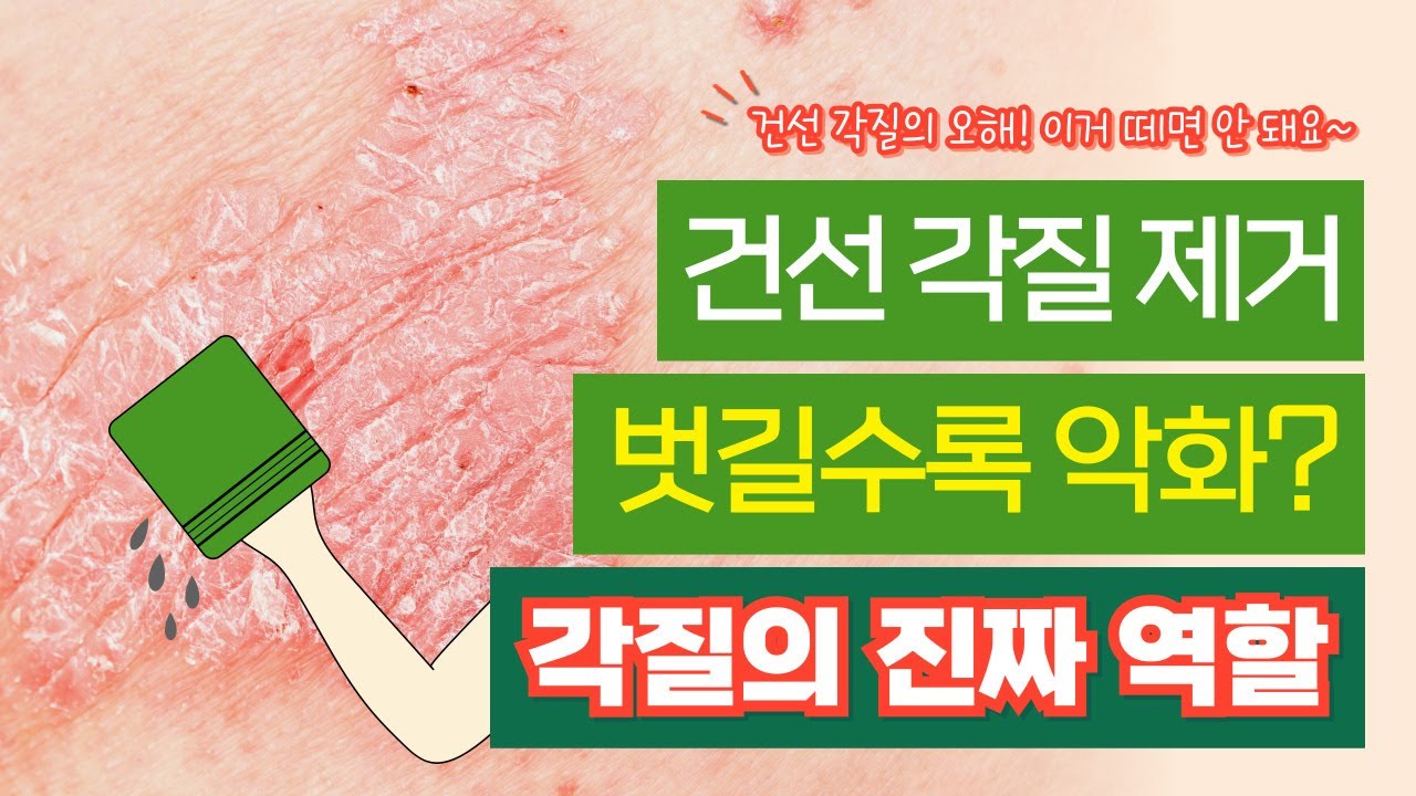 각질이 두꺼운데… 건선은 왜 벗기면 안 될까? 건선 각질 제거, 절대 하면 안 되는 이유 그리고 보습만으로 각질이 줄어드는 이유 (건선 관리 핵심)