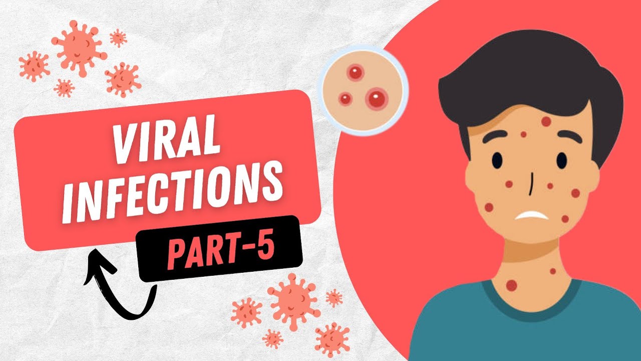 Molluscum Contagiosum, Ecthyma Contagiosum, Hand Foot and Mouth disease,  Milkers nodule