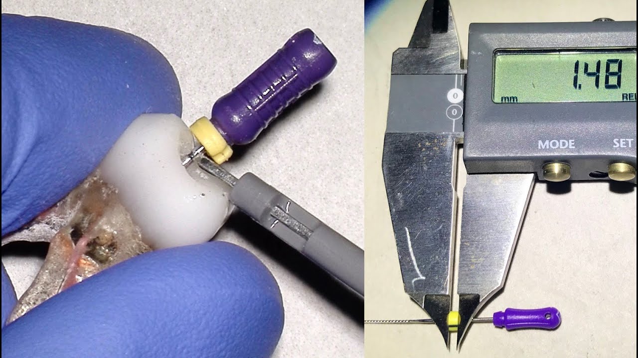 Root Canal File Rubber Stops - 3 Simple Tips