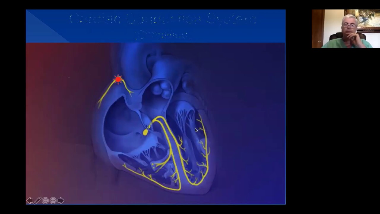Cardiac Arrhythmia: Brief Focused Approach. Part 1- Supraventricular Arrhythmia