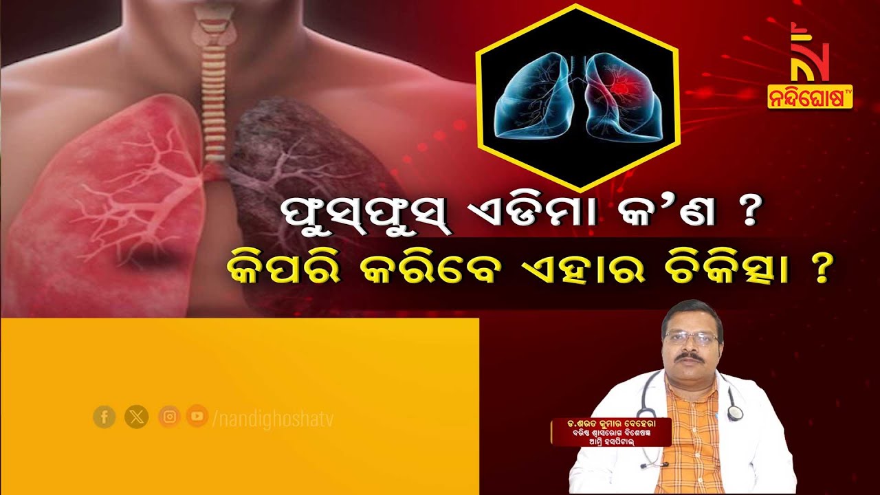 Pulmonary Edema - Symptoms & Causes | Dr. Sarat Kumar Behera | Swasthyasutra | Health Tips