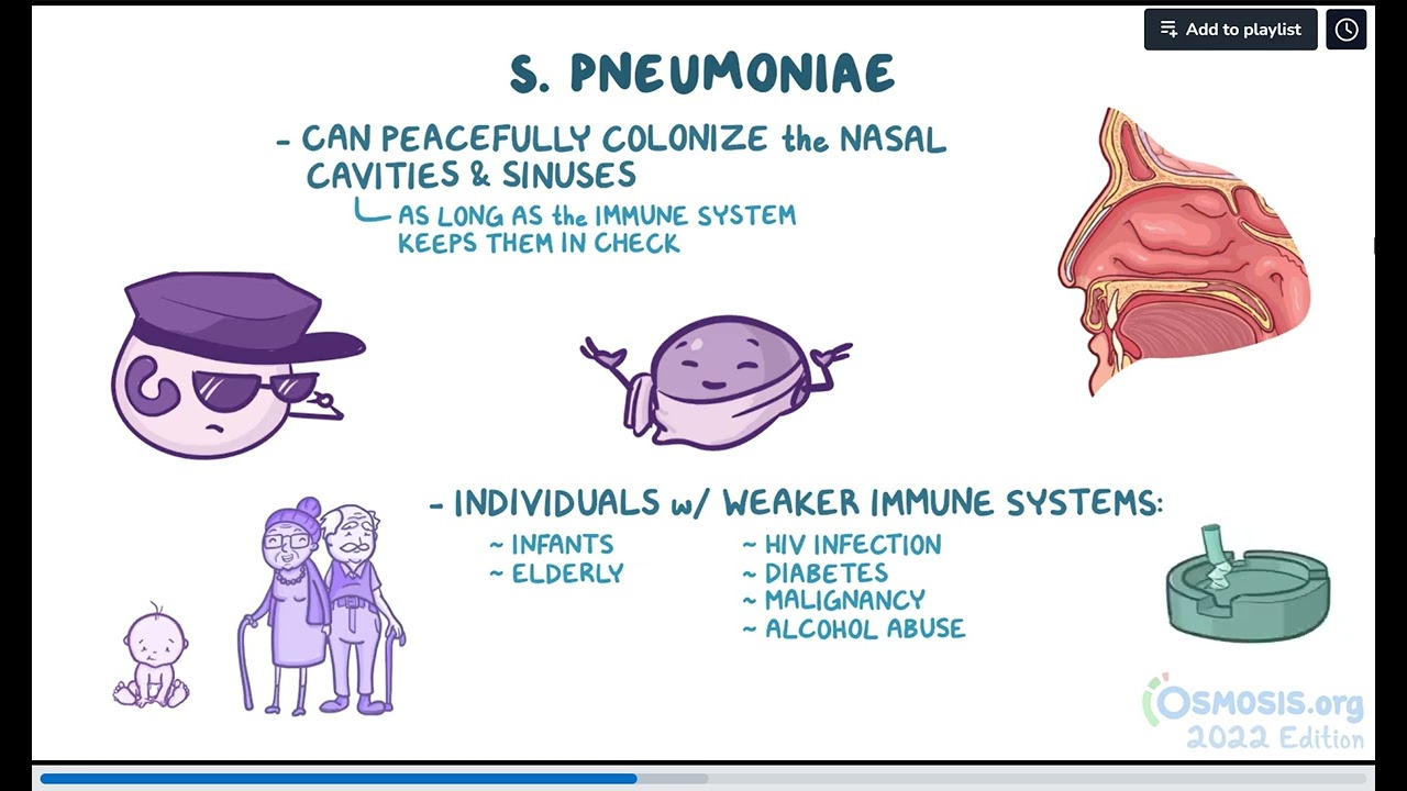 Streptococcus pneumoniae